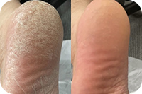 つるつるかかと