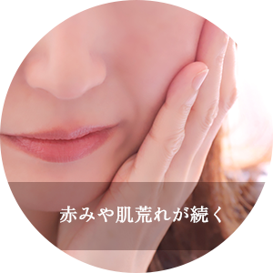 赤みや肌荒れが続く